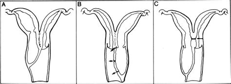 double vaginal